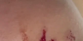 Aluna é agredida com socos, tapas e golpes de capacete por mãe e colega de escola em Patos de Minas